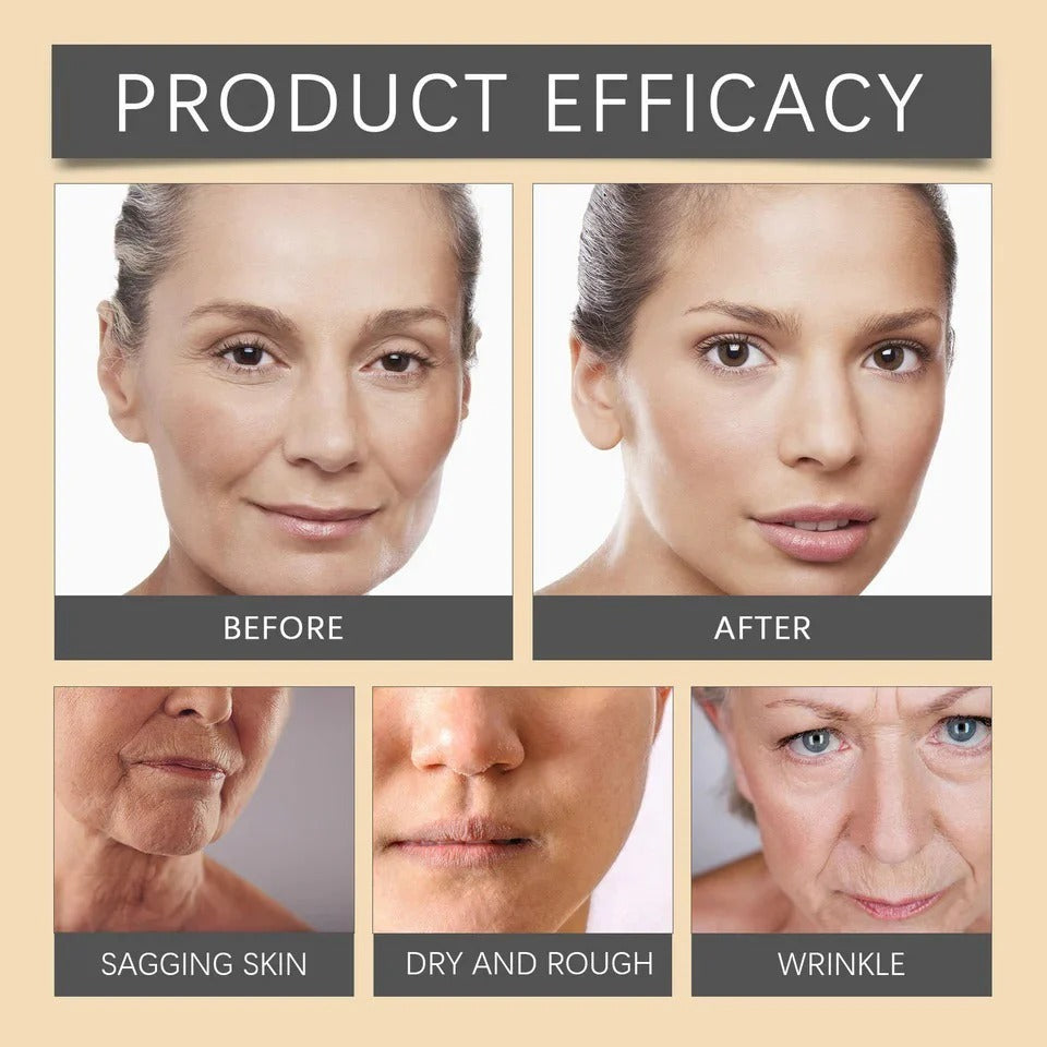 Botox Bee Venom Wrinkle Cream